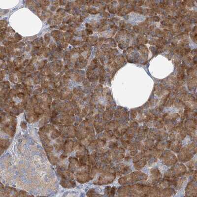 Immunohistochemistry-Paraffin: RPL4 Antibody [NBP1-81329]