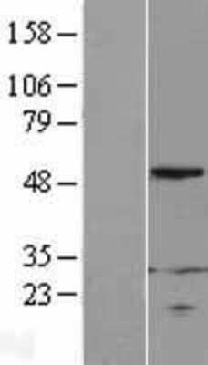 Western Blot: RPL4 Overexpression Lysate [NBL1-15539]