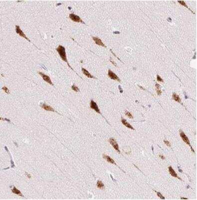 Immunohistochemistry-Paraffin: RPL41 Antibody [NBP2-30404]