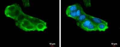 Immunocytochemistry/ Immunofluorescence: RPL5 Antibody [NBP1-31413]