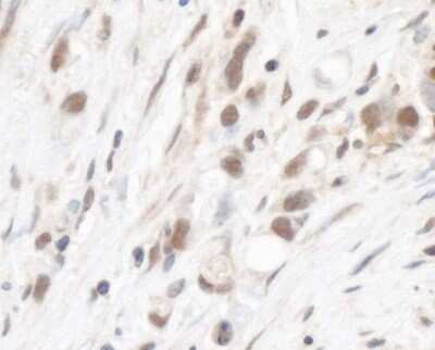 Immunohistochemistry-Paraffin: RPL5 Antibody [NBP2-22285]