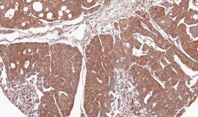 Immunohistochemistry-Paraffin: RPL5 Antibody [NBP1-31413]