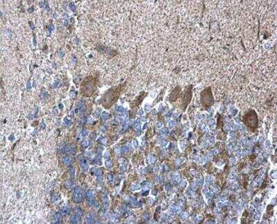Immunohistochemistry-Paraffin: RPL5 Antibody [NBP1-31413]