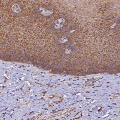 Immunohistochemistry-Paraffin: RPL5 Antibody [NBP1-92347]