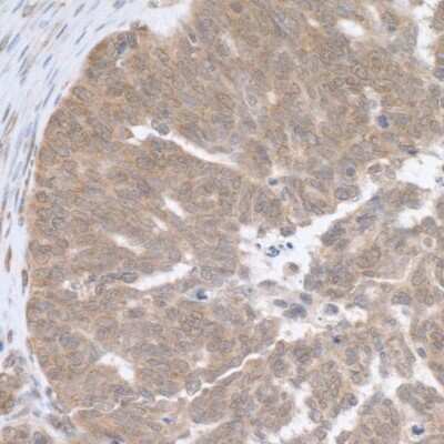 Immunohistochemistry-Paraffin: RPL5 Antibody [NBP2-22285]