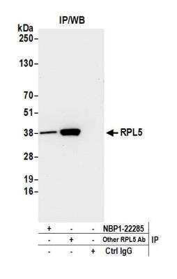 Immunoprecipitation: RPL5 Antibody [NBP2-22285]