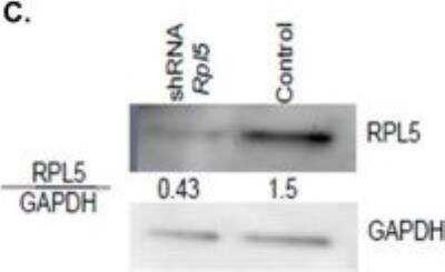 Knockdown Validated: RPL5 Antibody [NBP1-31413]