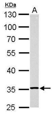Western Blot: RPL5 Antibody [NBP1-31413]