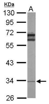 Western Blot: RPL5 Antibody [NBP1-31413]