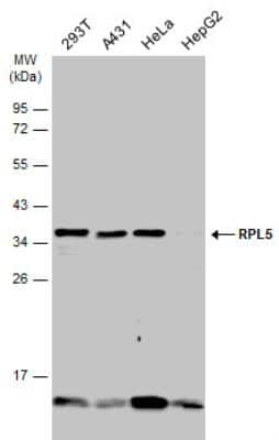 Western Blot: RPL5 Antibody [NBP1-31413]