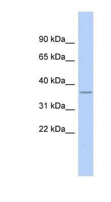 Western Blot: RPL5 Antibody [NBP1-57126]