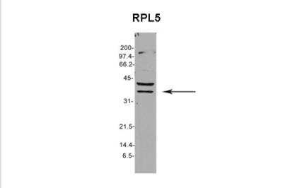 Western Blot: RPL5 Antibody [NBP1-57126]