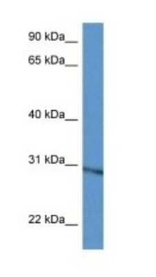 Western Blot: RPL5 Antibody [NBP1-74074]