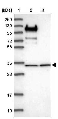 Western Blot: RPL5 Antibody [NBP1-92347]