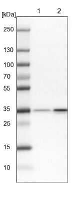 Western Blot: RPL5 Antibody [NBP1-92347]