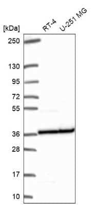 Western Blot: RPL5 Antibody [NBP2-68710]