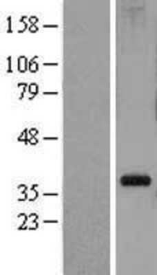 Western Blot: RPL5 Overexpression Lysate [NBL1-15541]