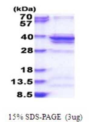 SDS-PAGE: Recombinant Human RPL5 His Protein [NBP2-51794]