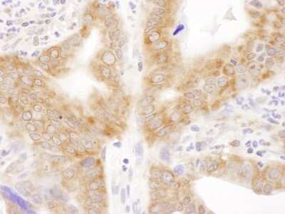 Immunohistochemistry-Paraffin: RPL6 Antibody [NBP2-04034]