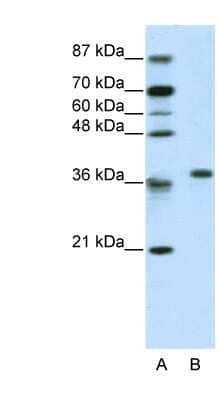 Western Blot: RPL6 Antibody [NBP1-57526]