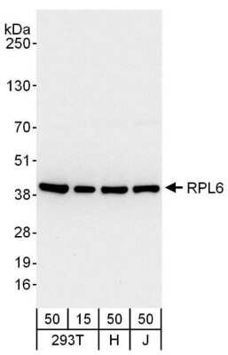 Western Blot: RPL6 Antibody [NBP2-04034]