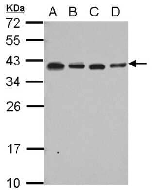 Western Blot: RPL6 Antibody [NBP2-20216]