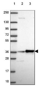 Western Blot: RPL6 Antibody [NBP2-49552]