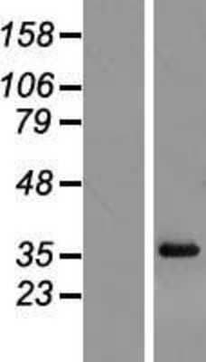 Western Blot: RPL6 Overexpression Lysate [NBL1-15542]