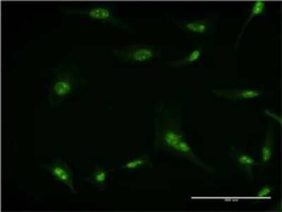 Immunocytochemistry/ Immunofluorescence: RPL7 Antibody (2E10) [H00006129-M06]