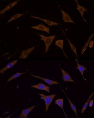 Immunocytochemistry/ Immunofluorescence: RPL7 Antibody - Azide and BSA Free [NBP2-93625]