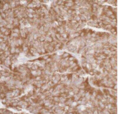 Immunohistochemistry-Paraffin: RPL7 Antibody [NB100-2269]