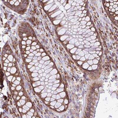 Immunohistochemistry-Paraffin: RPL7 Antibody [NBP2-34111]