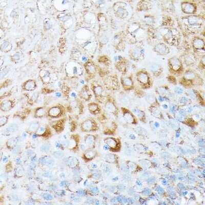 Immunohistochemistry-Paraffin: RPL7 Antibody - Azide and BSA Free [NBP2-93625]