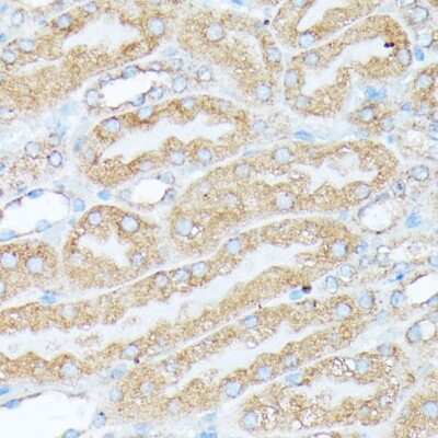 Immunohistochemistry-Paraffin: RPL7 Antibody - Azide and BSA Free [NBP2-93625]