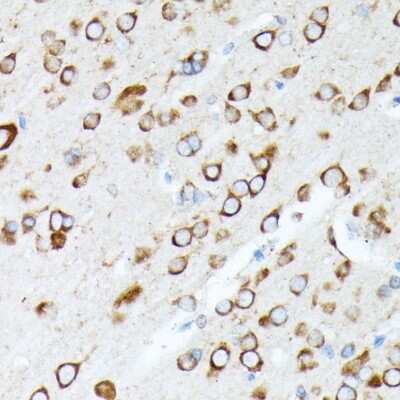 Immunohistochemistry-Paraffin: RPL7 Antibody - Azide and BSA Free [NBP2-93625]
