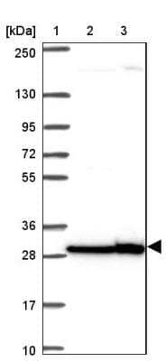 Western Blot: RPL7 Antibody [NBP2-34111]