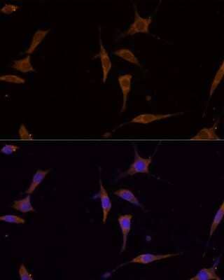Immunocytochemistry/ Immunofluorescence: RPL7A Antibody - Azide and BSA Free [NBP2-93830]