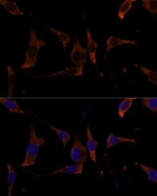 Immunocytochemistry/ Immunofluorescence: RPL7A Antibody - Azide and BSA Free [NBP2-94629]