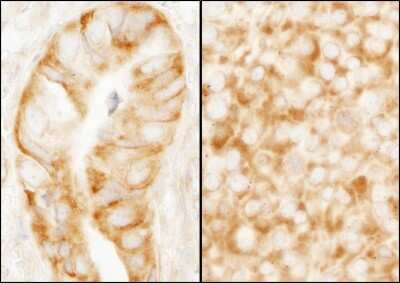 Immunohistochemistry-Paraffin: RPL7A Antibody [NB100-2277]