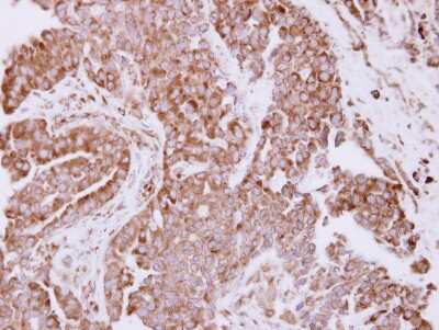 Immunohistochemistry-Paraffin: RPL7A Antibody [NBP2-20217]