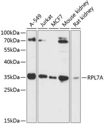 Western Blot: RPL7A AntibodyAzide and BSA Free [NBP2-93830]