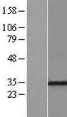 Western Blot: RPL7A Overexpression Lysate [NBL1-15544]