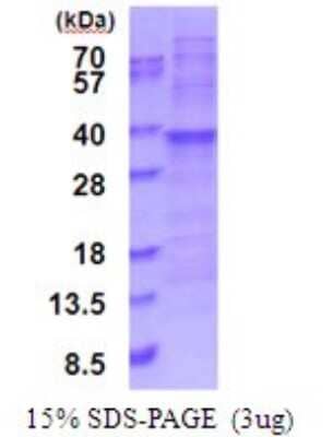 SDS-PAGE: Recombinant Human RPL7A His Protein [NBP2-51895]