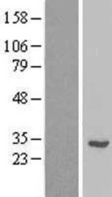 Western Blot: RPL7L1 Overexpression Lysate [NBL1-15545]