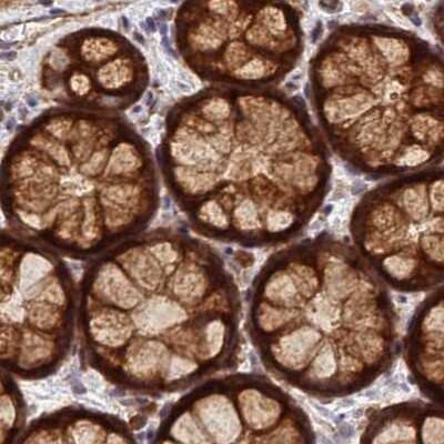 Immunohistochemistry-Paraffin: RPL8 Antibody [NBP2-48827]