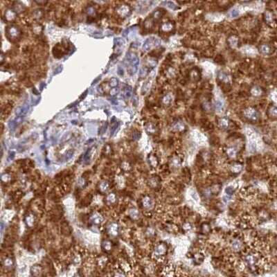 Immunohistochemistry-Paraffin: RPL8 Antibody [NBP2-48827]