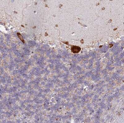Immunohistochemistry-Paraffin: RPL8 Antibody [NBP2-48827]
