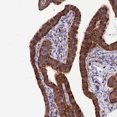 Immunohistochemistry-Paraffin: RPL8 Antibody [NBP2-48827]