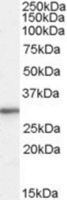 Western Blot: RPL8 Antibody [NB100-68143]