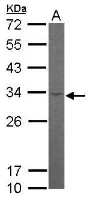 Western Blot: RPL8 Antibody [NBP1-33294]